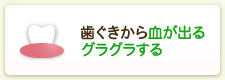 歯ぐきから血が出るグラグラする