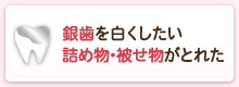 銀歯を白くしたい詰め物･被せ物がとれた