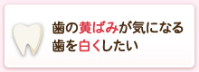 歯の黄ばみが気になる歯を白くしたい