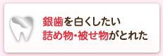 銀歯を白くしたい詰め物･被せ物がとれた