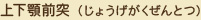 上下顎前突（じょうげがくぜんとつ）